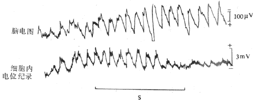 脑电图与皮层神经元细胞内电位记录的关系