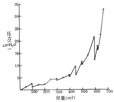 人膀胱充盈过程中膀胱容量与压力的关系