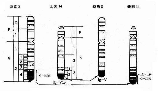 Burkitt淋巴瘤常见的染色体易位t(8:14)