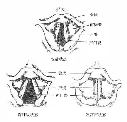 声门裂的变化