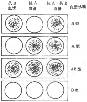 ABO血型的测定