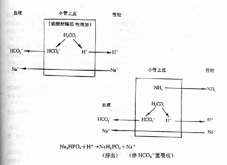 一、代谢性酸中毒