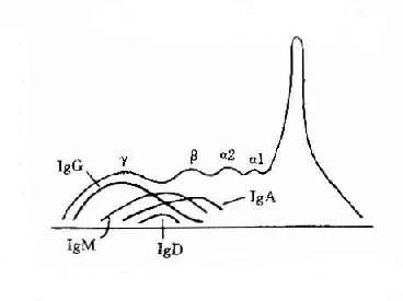 不同类免疫球收白的电泳分离图