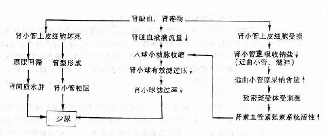 急性肾小管坏死引起的肾功能衰竭时少尿发病机制示意图