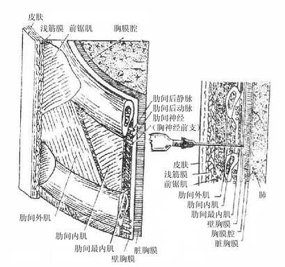 肋间血管走行图片