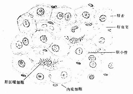 肝索肝窦手绘图图片