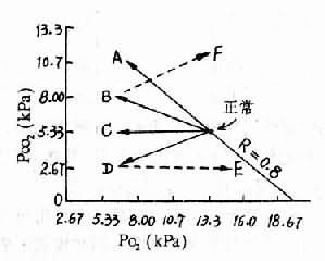 （二）PaO<sub>2</sub>下降而Paco<sub>2</sub>变动不大