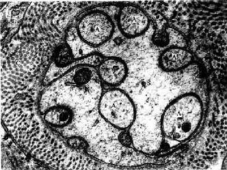 大鼠无髓神经纤维横切电镜像 