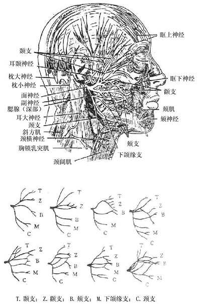 面神经及常见分支类型