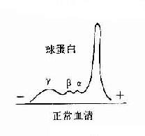 兔血清电泳分离图