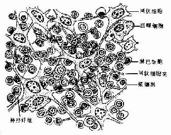 淋巴结组胚示意图图片