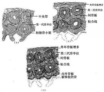 骨密质改建示意图 